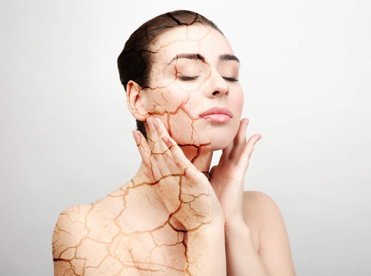 Microneedling es el tratamiento de Montserrat Travé para rejuvenecer el rostro