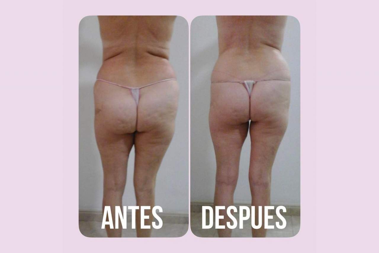 Vanesa Vendrell Estética es el centro de estética tendencia en el corazón de Valencia para tratamientos reductores y anticelulíticos