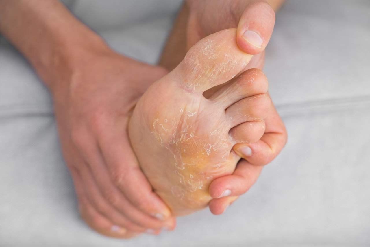Tejido técnico para curar heridas: La revolución del tejido Muvu en Parafarmacia Integrativa