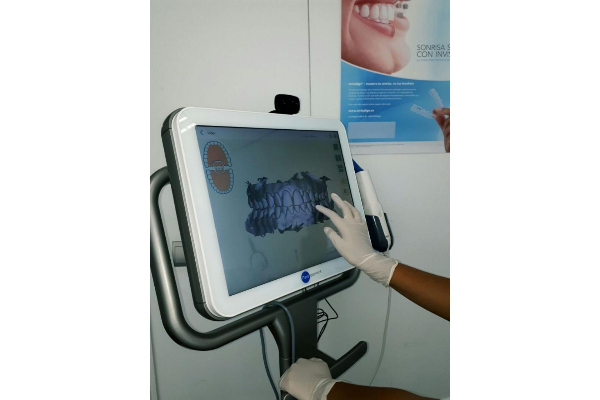 Clínica de Ortodoncia Mariana Sacoto Navia es la única clínica en Barcelona especializada en ortodoncia invisible Invisalign®