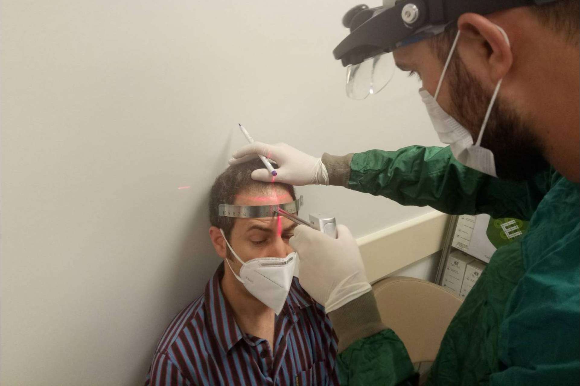 La clínica española Fue Hair Transplant System realiza trasplante capilar en Turquía