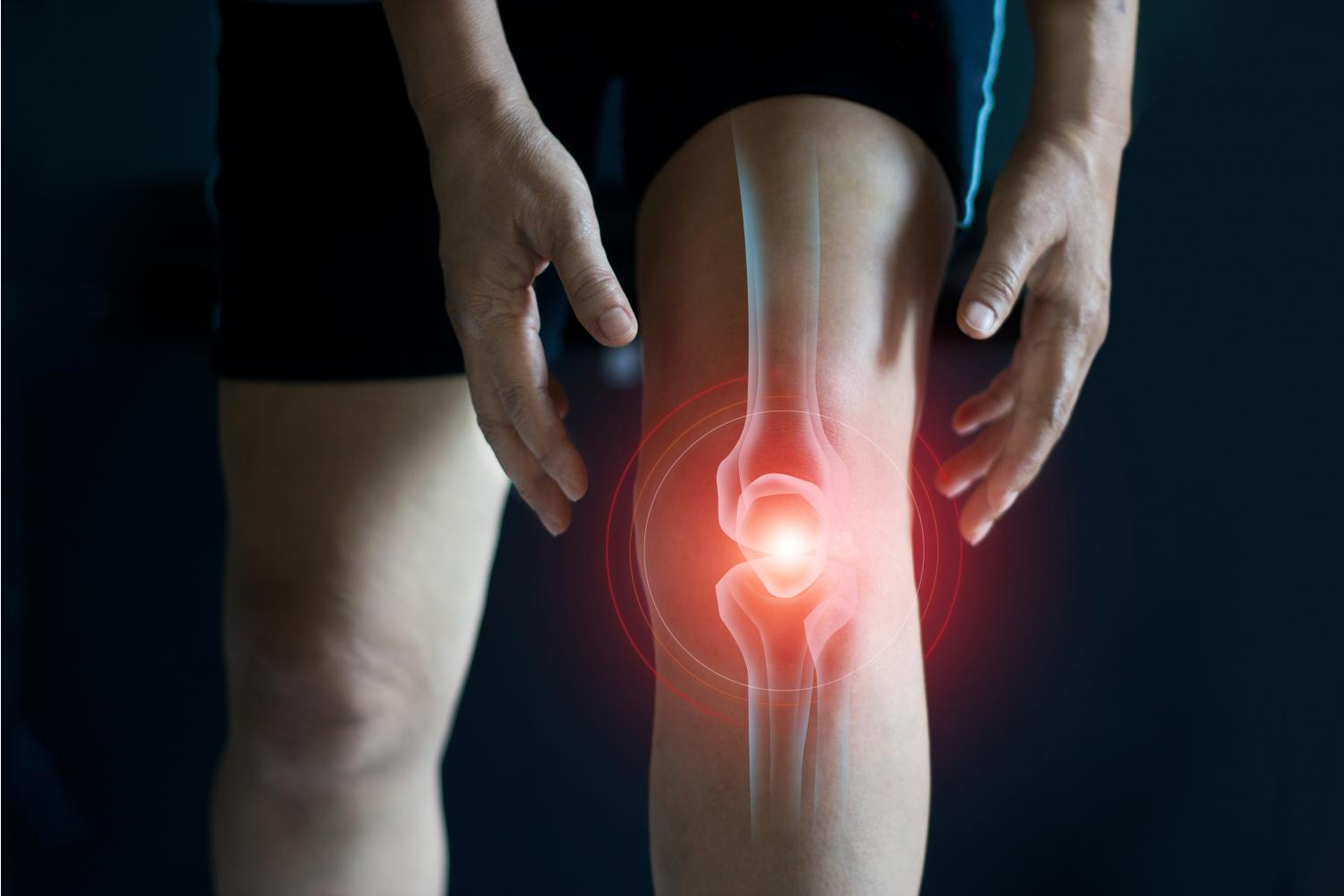 El colágeno con silicio de Novonatur actúa suplemento vitamínico para proteger los huesos y los ligamentos
