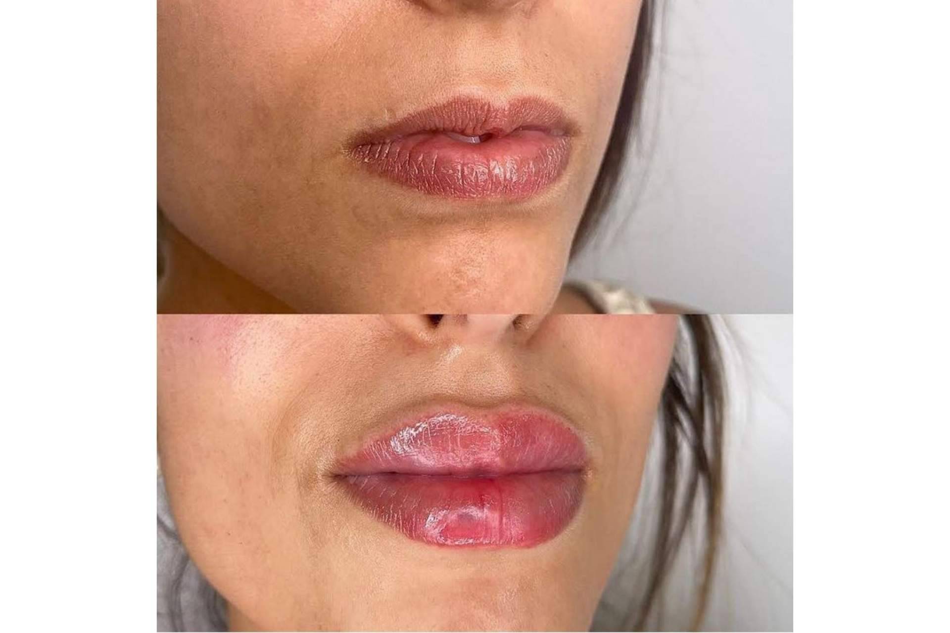 El doctor Castellar revitaliza la expresión facial de mujeres y hombres con sus tratamientos estéticos