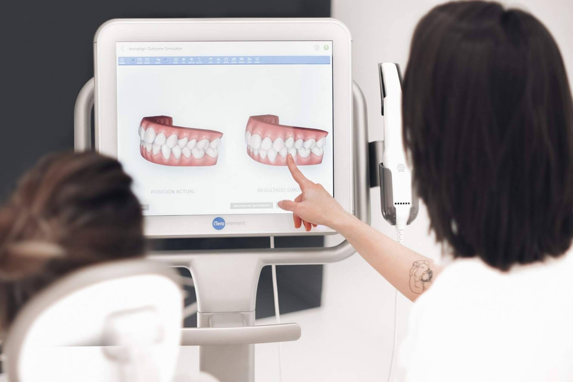 Ortodoncia invisible con el tratamiento Invisalign en Murcia, por Centros en Línea