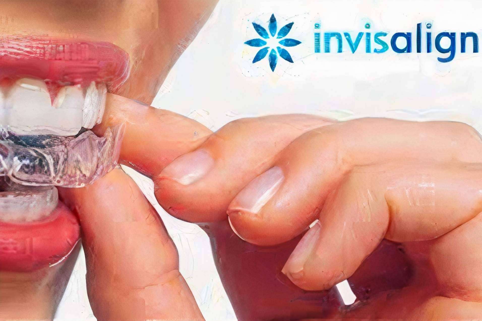 La técnica Invisaling en Valencia es cada vez más exitosa