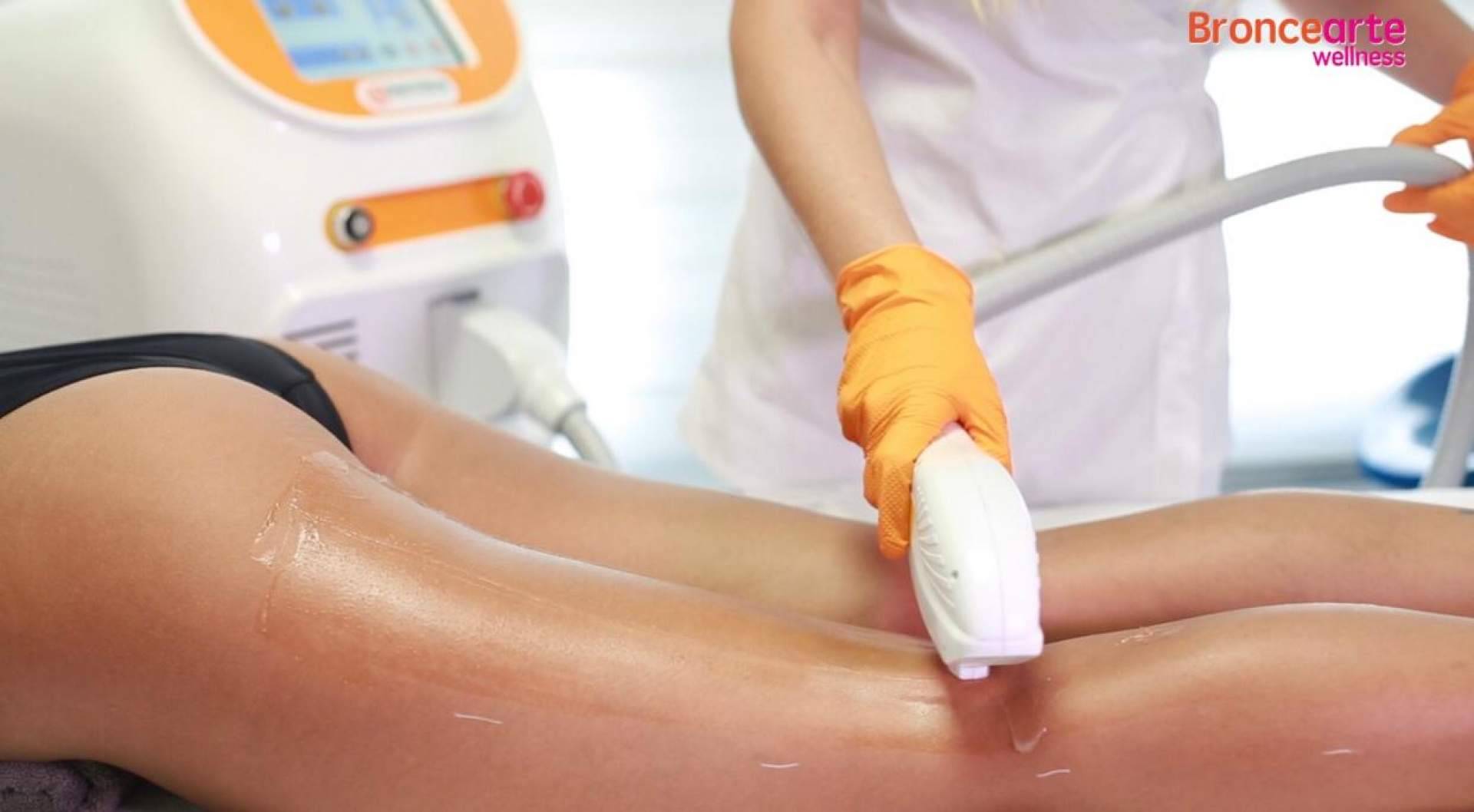 La alternativa a la depilación tradicional: la depilación láser que realiza Broncearte Wellness
