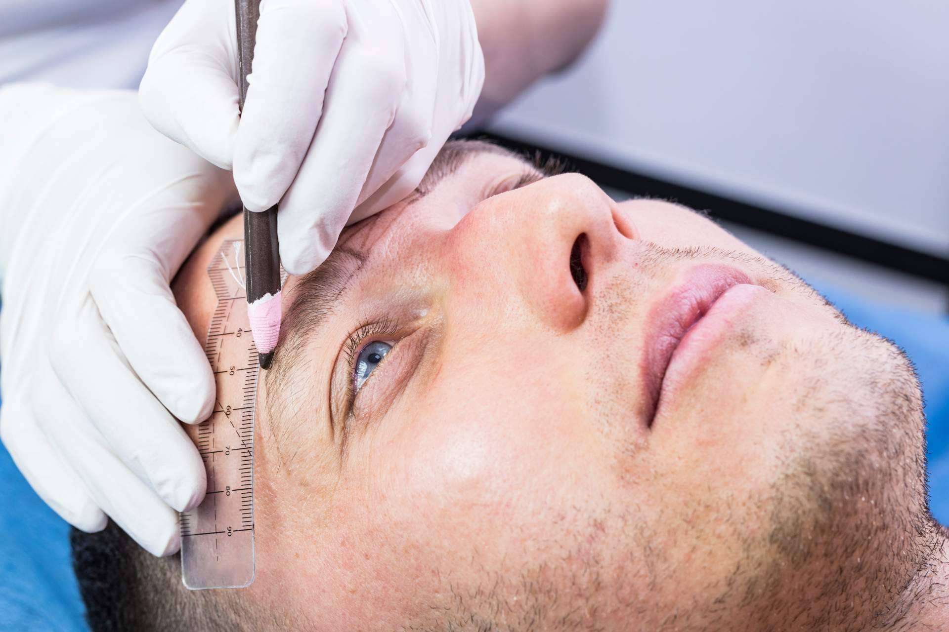 El trasplante capilar en las cejas: Clínicas Dr. Pelo