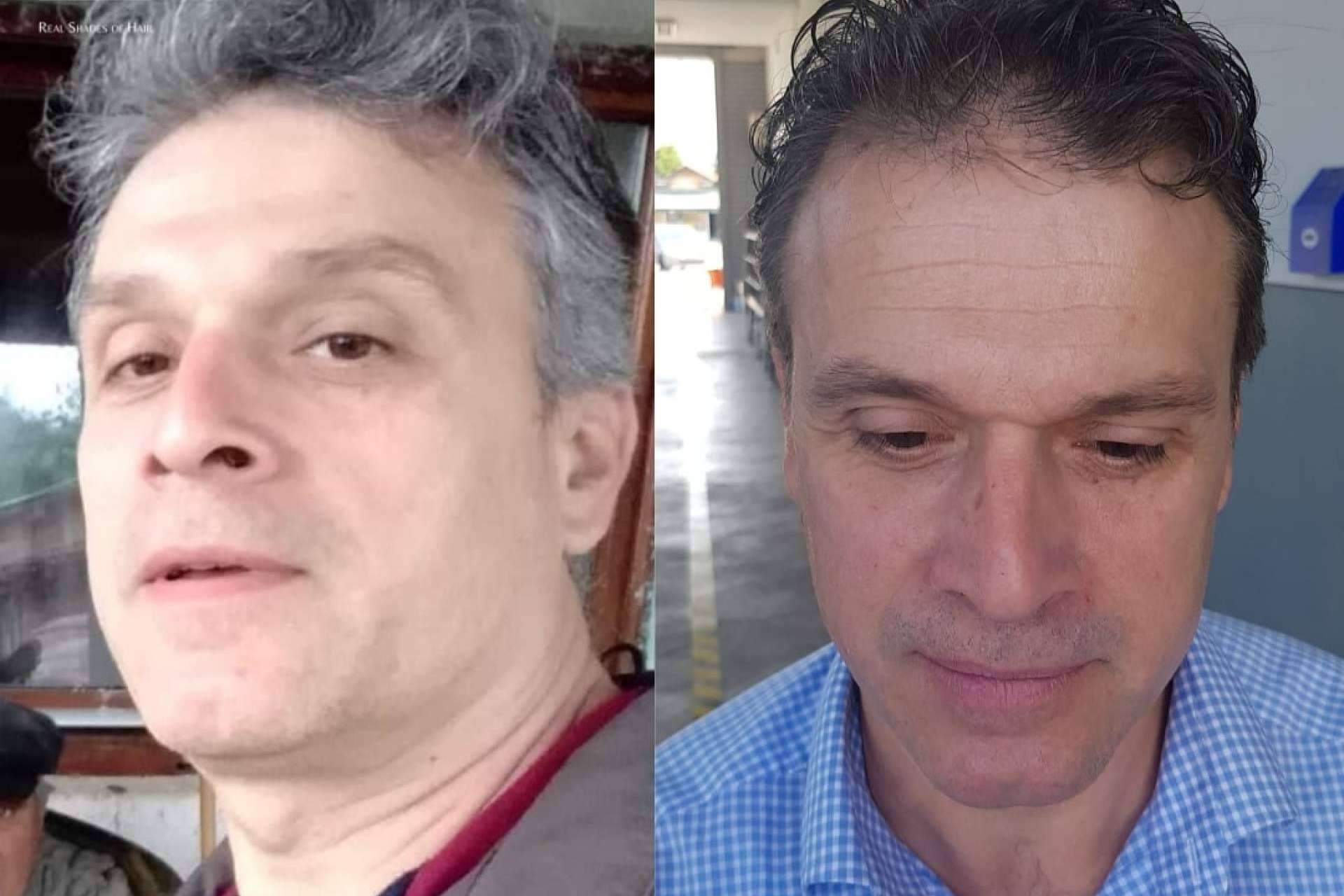 GR-7 Professional: la sinergia de 4 componentes naturales para hacer desaparecer las canas