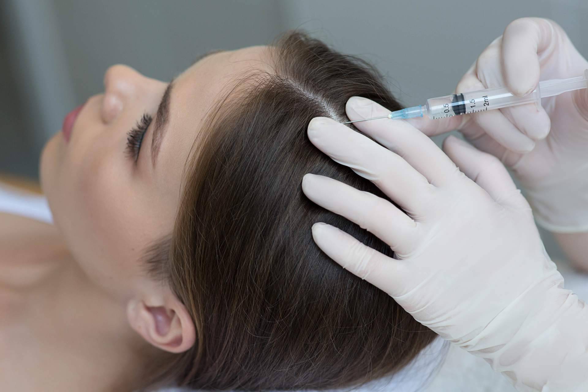 Tratamientos de Élite Capilar: ¿Láser capilar o mesoterapia capilar?