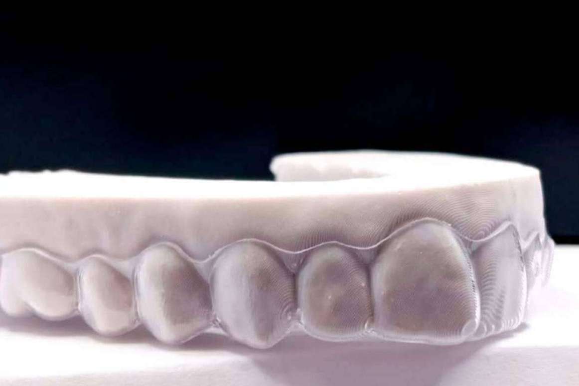 ¿Qué es la ortodoncia invisible?: Clínicas Hernadent