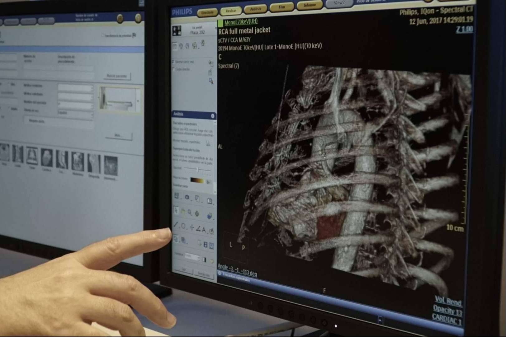 Bach Care ofrece un escáner de imagen espectral que permite prevenir y detectar patologías o anomalías cardiovasculares