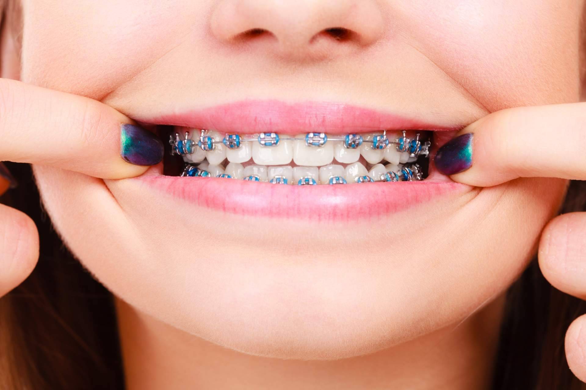 Los expertos de Clínica Sonrisas de Corrales Dental ofrecen una ortodoncia de máxima calidad en Badajoz