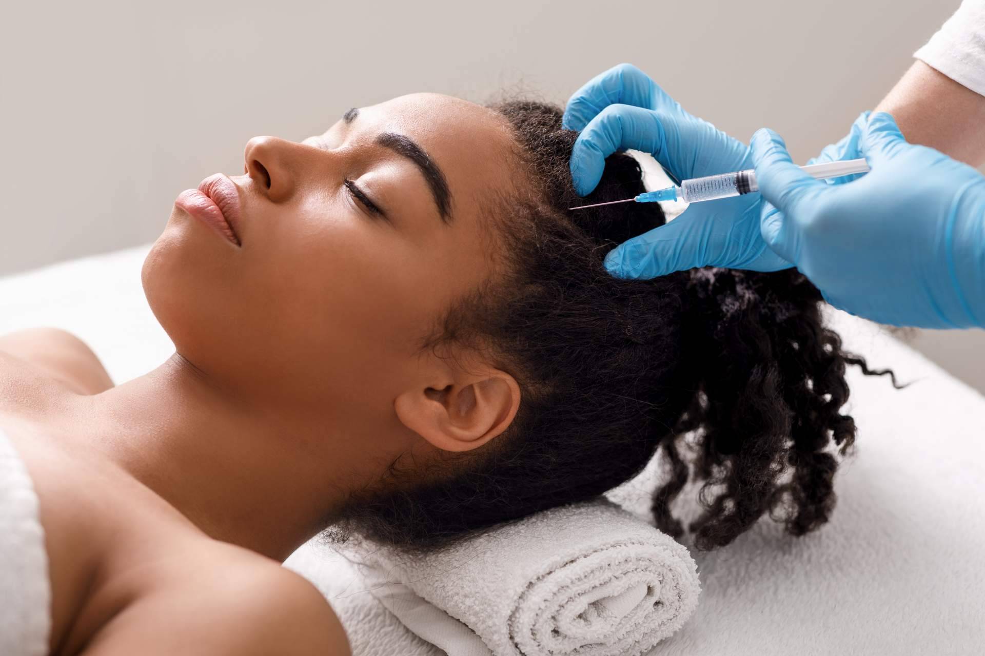 Las ventajas de la mesoterapia capilar que realiza el Dr. Bruno Jacobovski