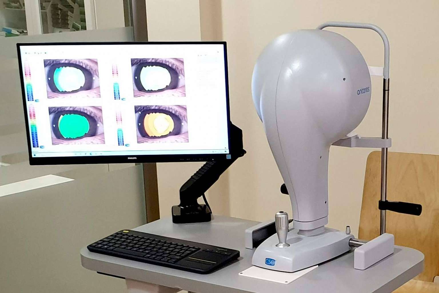 Los equipos de topografía corneal de GX2 aseguran los resultados más completos