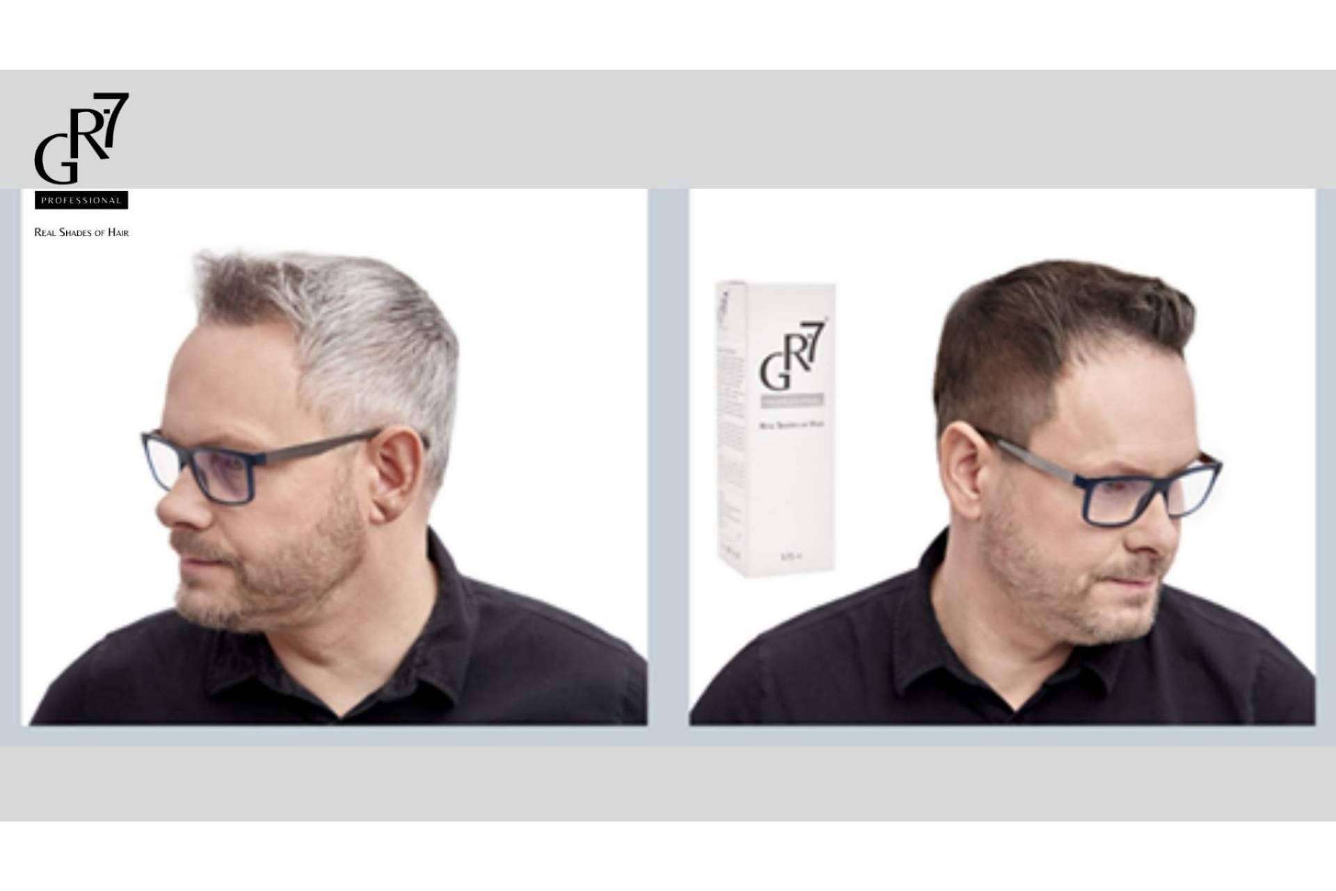 Estimulando la producción de melanina desaparecen las canas con GR-7 Professional