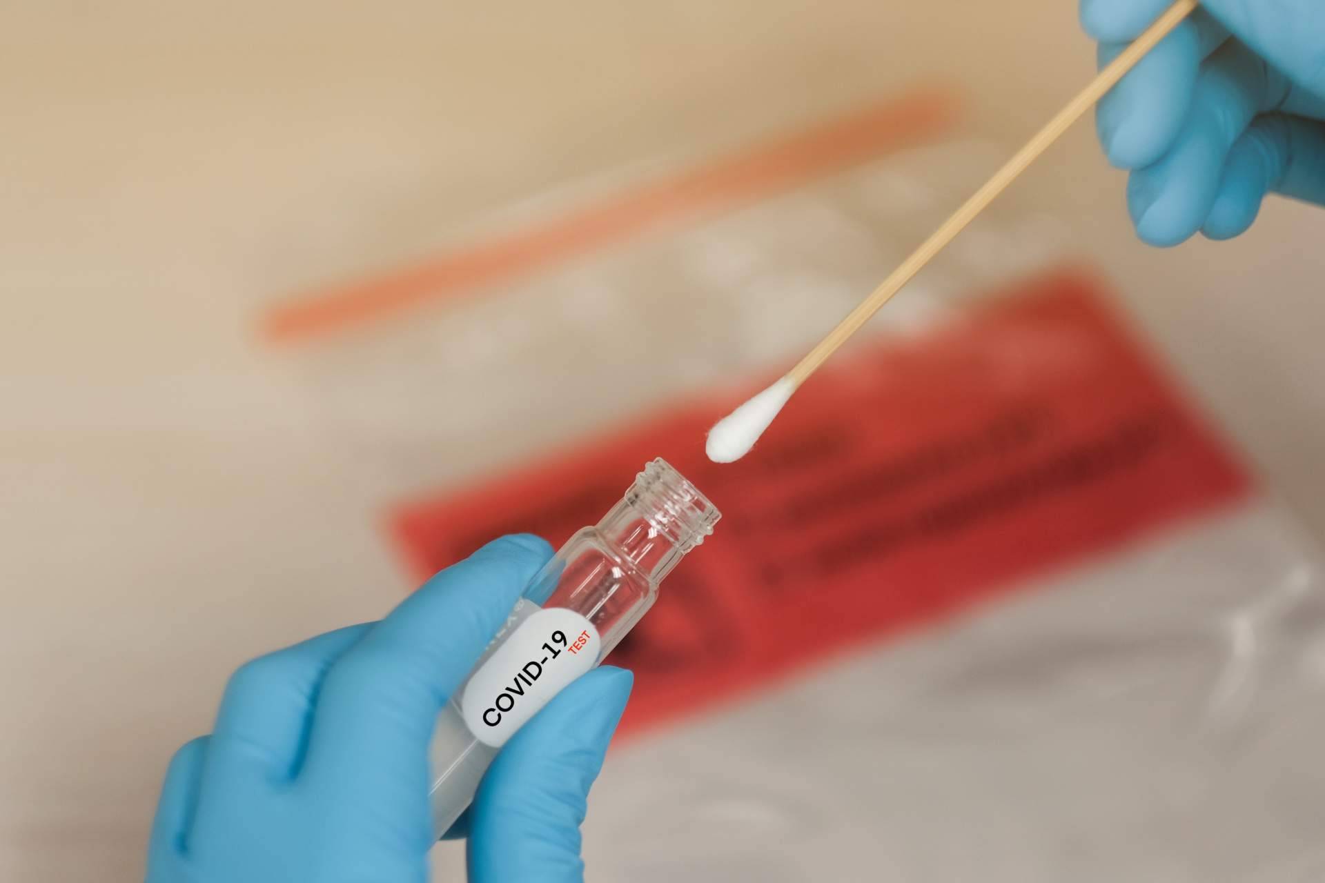 ¿Por qué es importante realizarse un test COVID a pesar de tener la pauta de vacunación completa, según Centro Médico Bravo