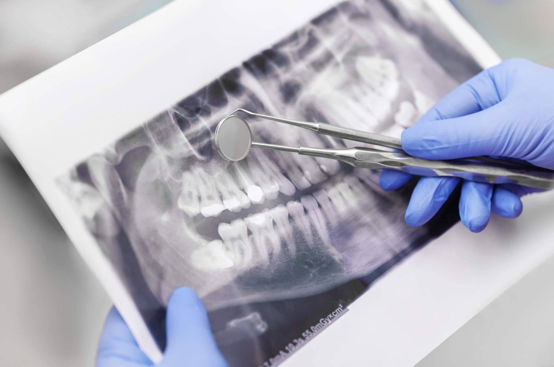 Las claves de un servicio técnico dental, por Star Dent