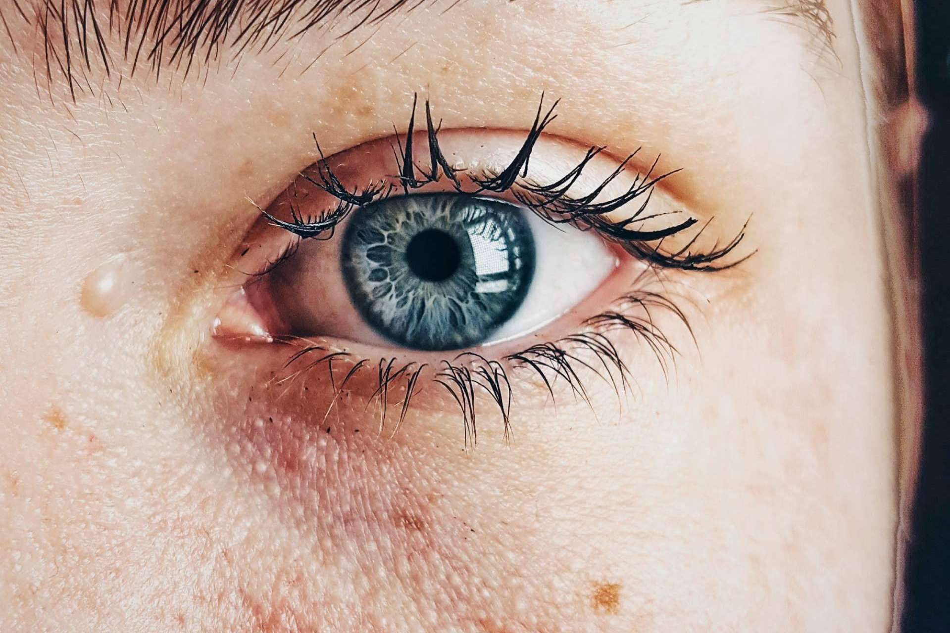 Evitar el síndrome de ojo seco con una higiene ocular adecuada