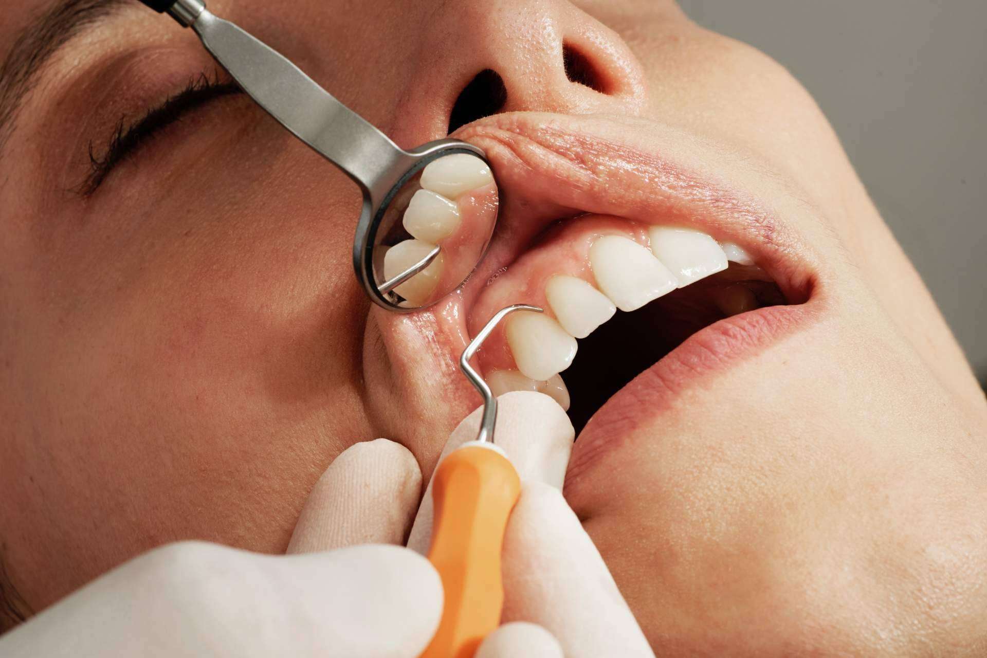 Clínica Sanzmar dispone de un equipo especializado en periodoncia