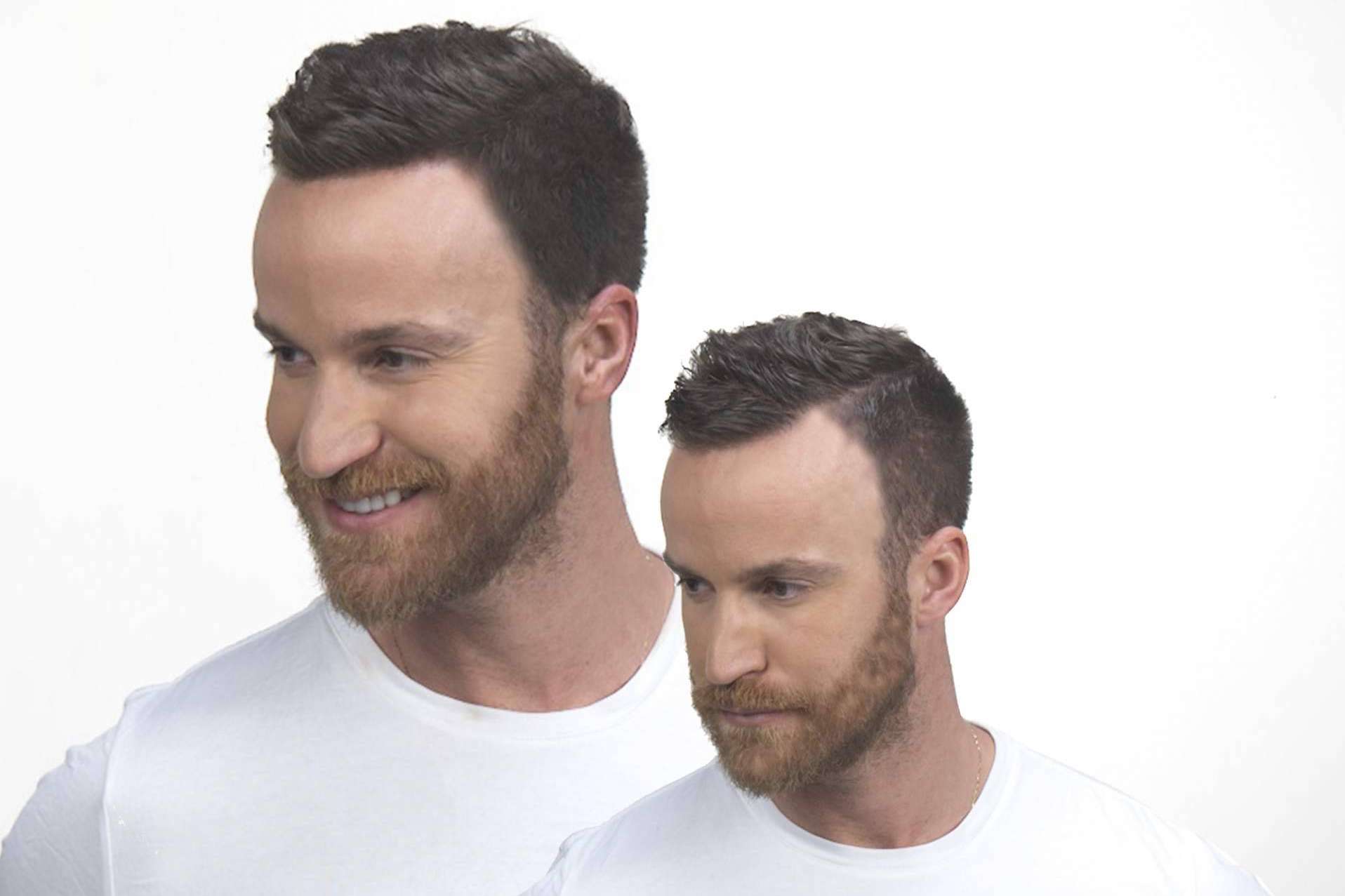 Tratar la caída de cabello con las fibras capilares 100 % naturales de Kmax