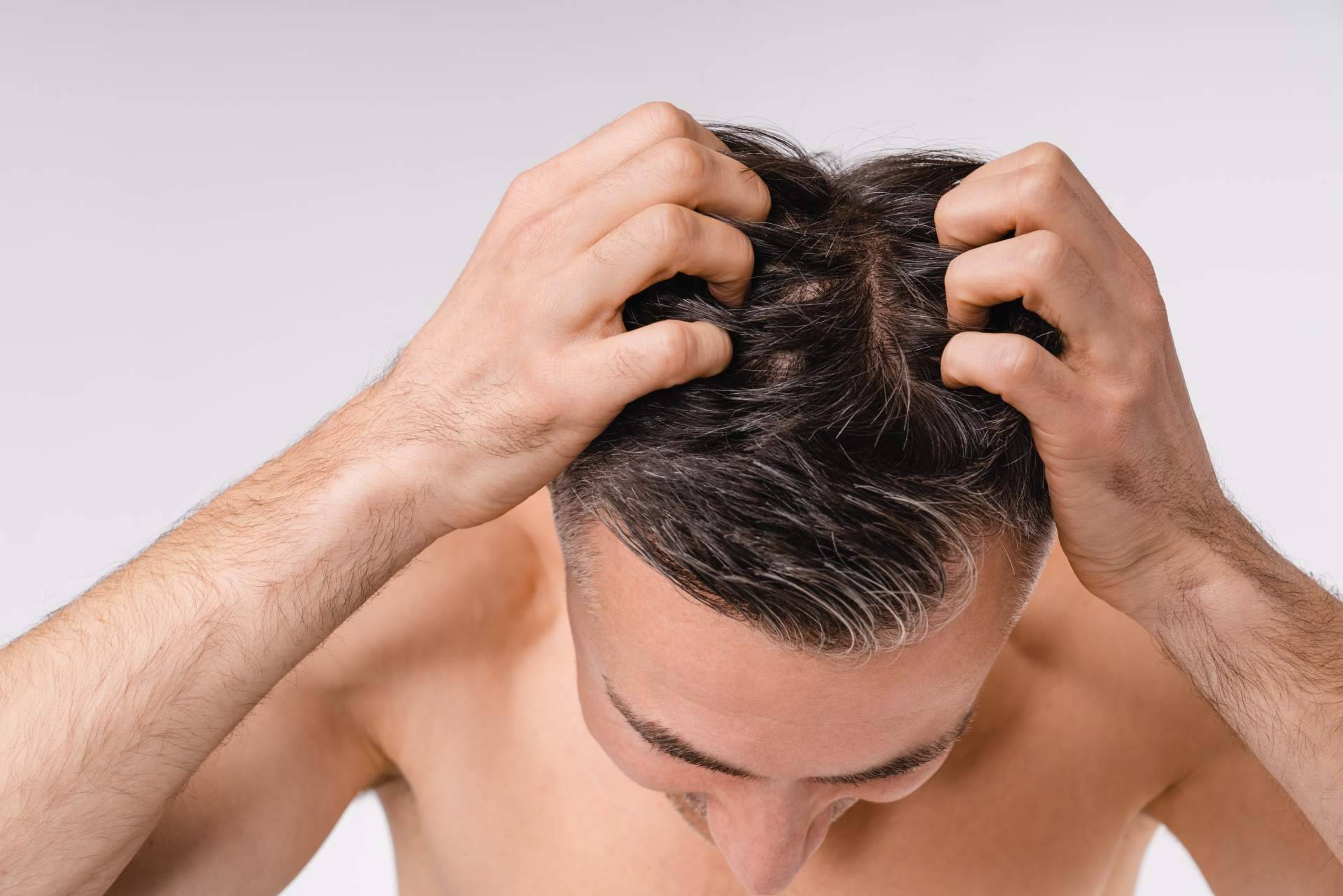 Beneficios del tratamiento de láser capilar de baja frecuencia, por Élite Capilar