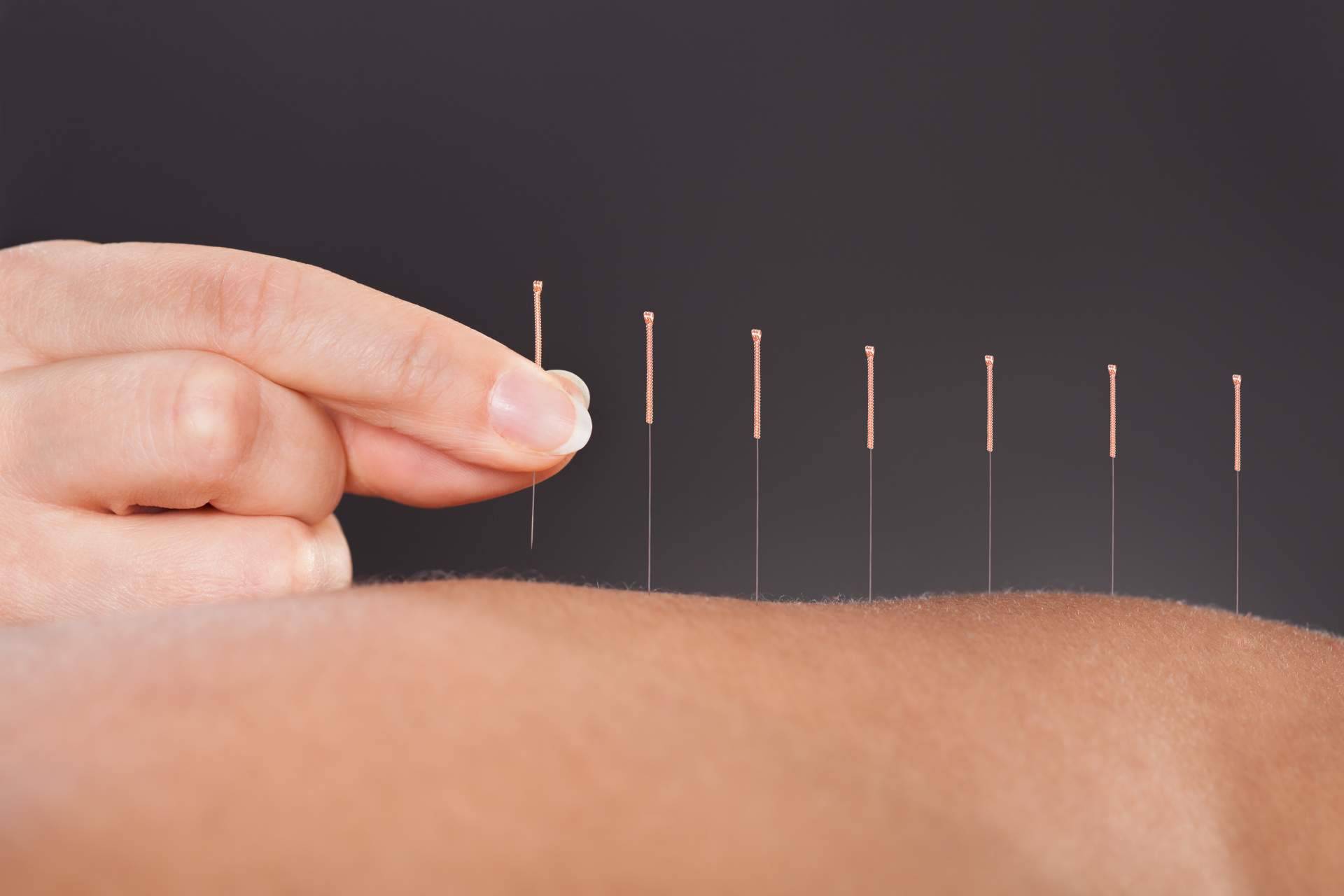 Trabajar de acupuntor y osteópata con formación internacional profesional