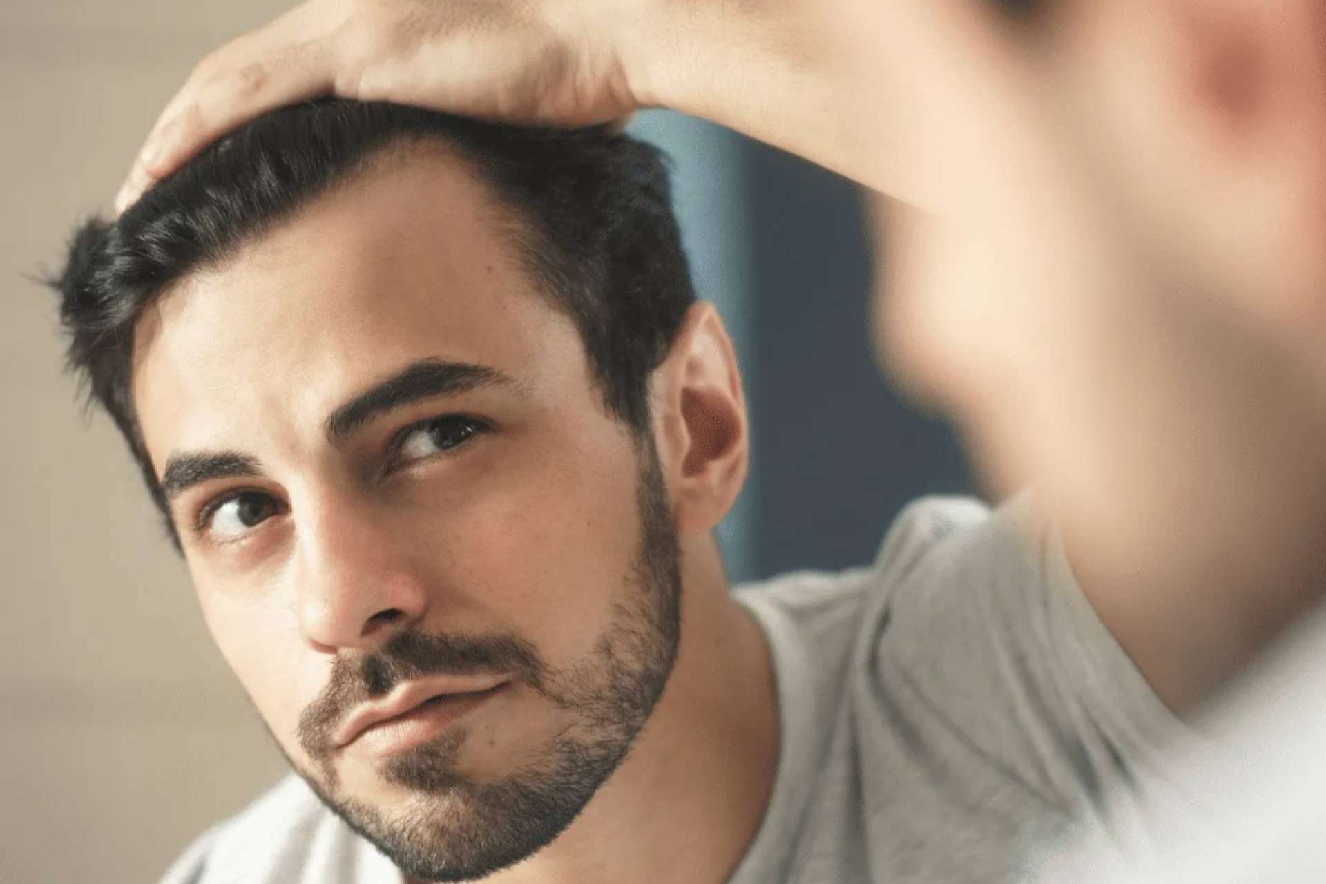 El Dr. Antonio Fernández Brito lleva a cabo el microinjerto capilar en Madrid en Microcapilar Hair Clinic