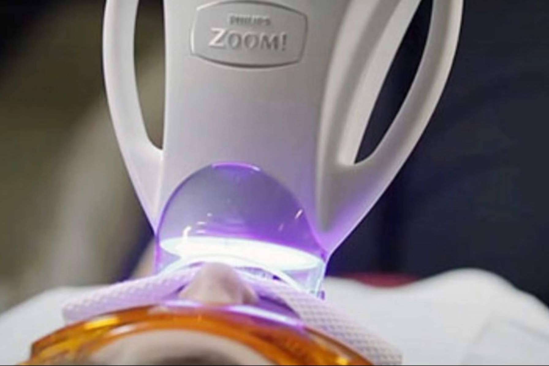 El blanqueamiento dental en casa refuerza los resultados del procedimiento clínico