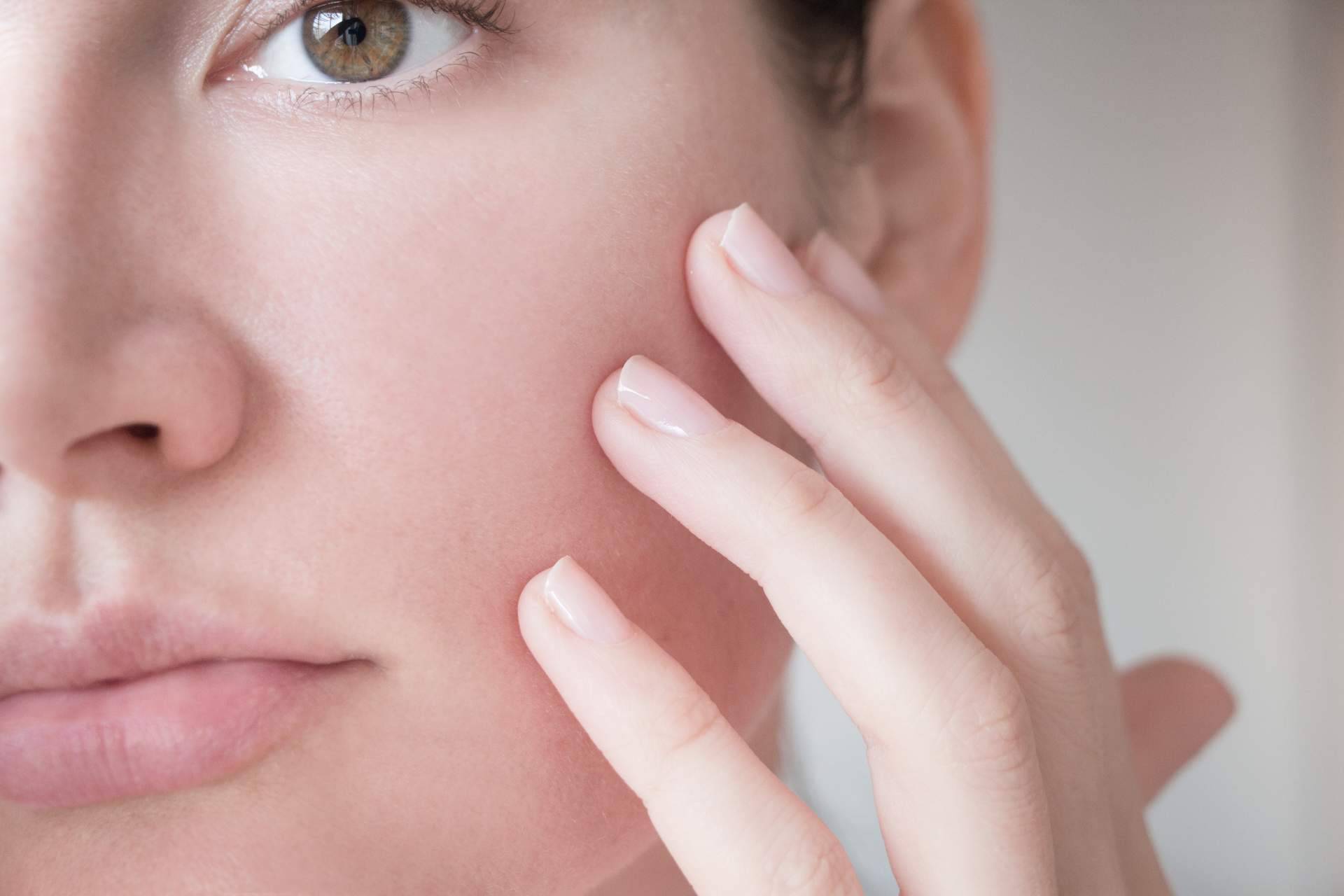 Tratamientos para las manchas en la piel y cómo prevenir para el verano, por Farmacia Laura Garín