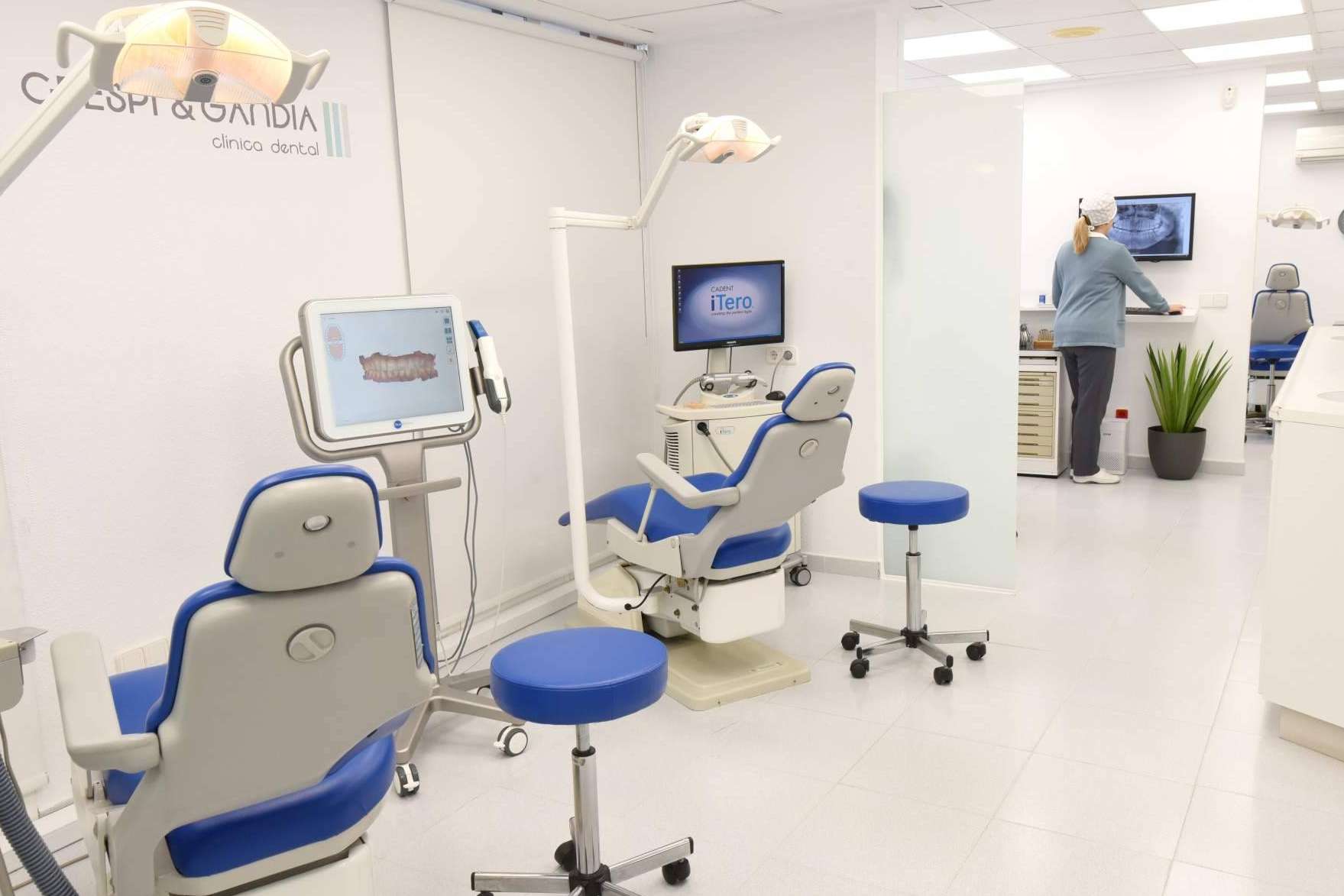 Las carillas dentales ayudan a recuperar la estética de la sonrisa en un día