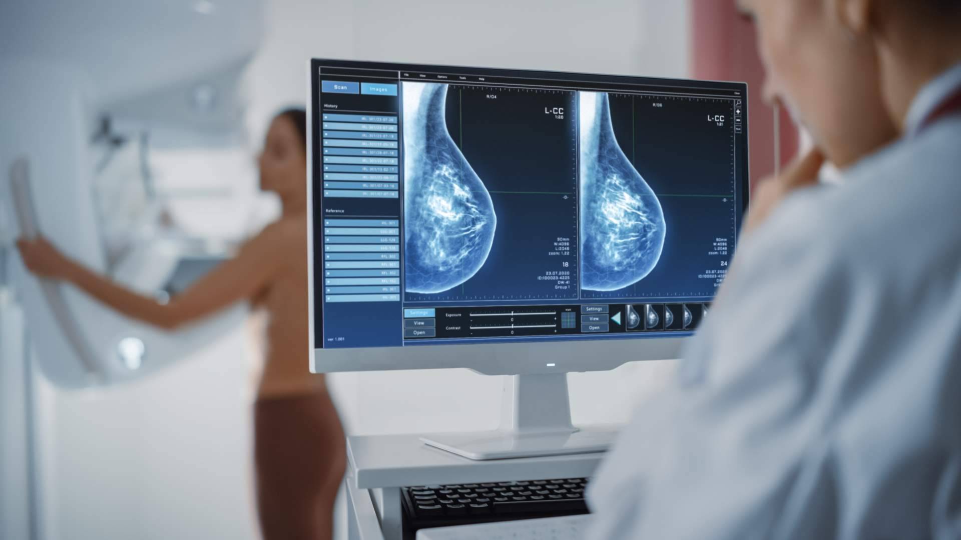 Genotipia y la oncología de precisión