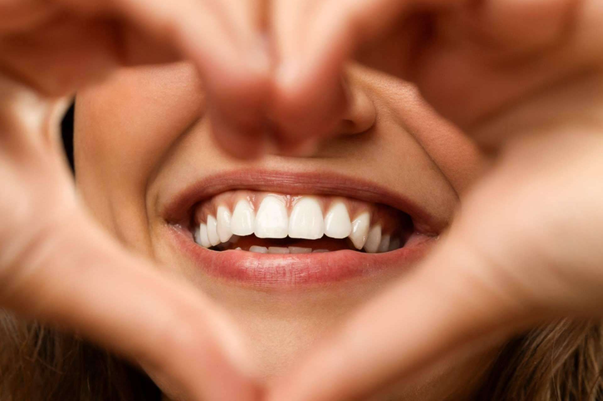 Blanqueamientos dentales, con Bordonclinic