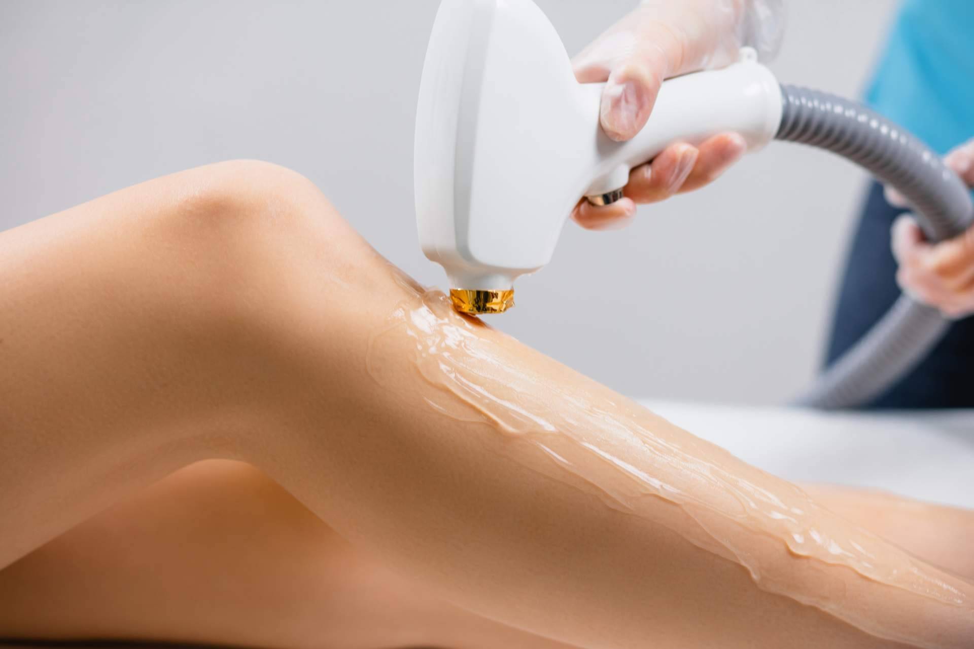 Cuáles son los beneficios del láser de diodo Venus de Comercial Estética