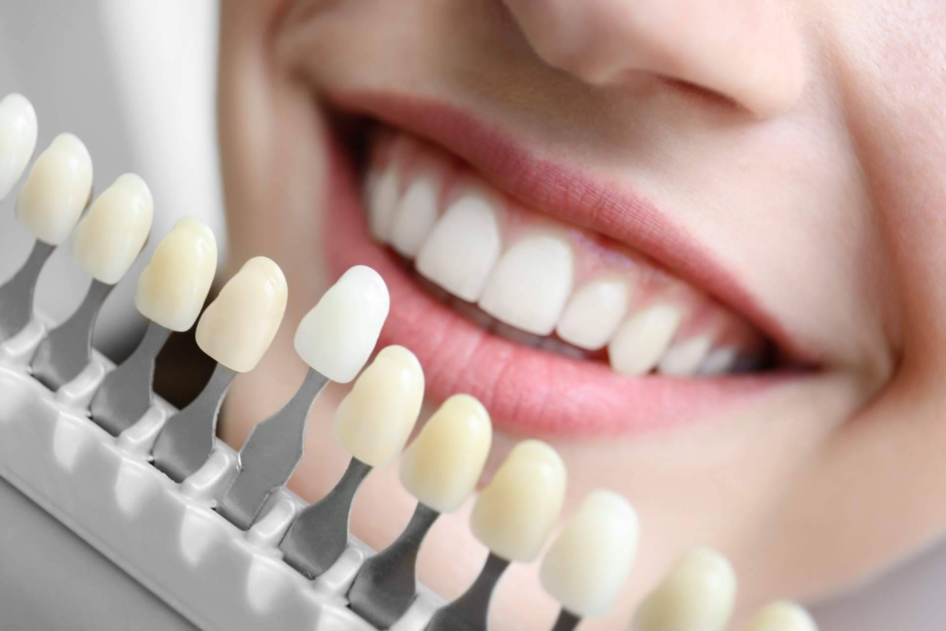 Los implantes y el tratamiento de ortodoncia aplicados por DrMouth