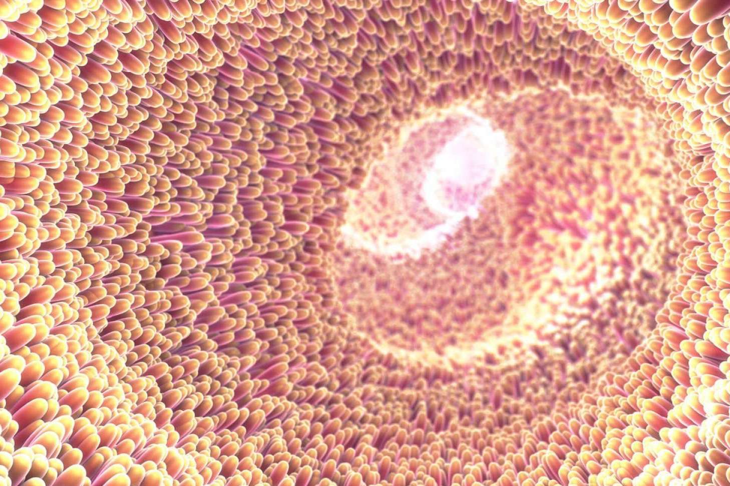 El Dr Fernando Ruger Viarengo, director de Clínica Umebir, aclara la autoinmunidad que se inicia en el intestino