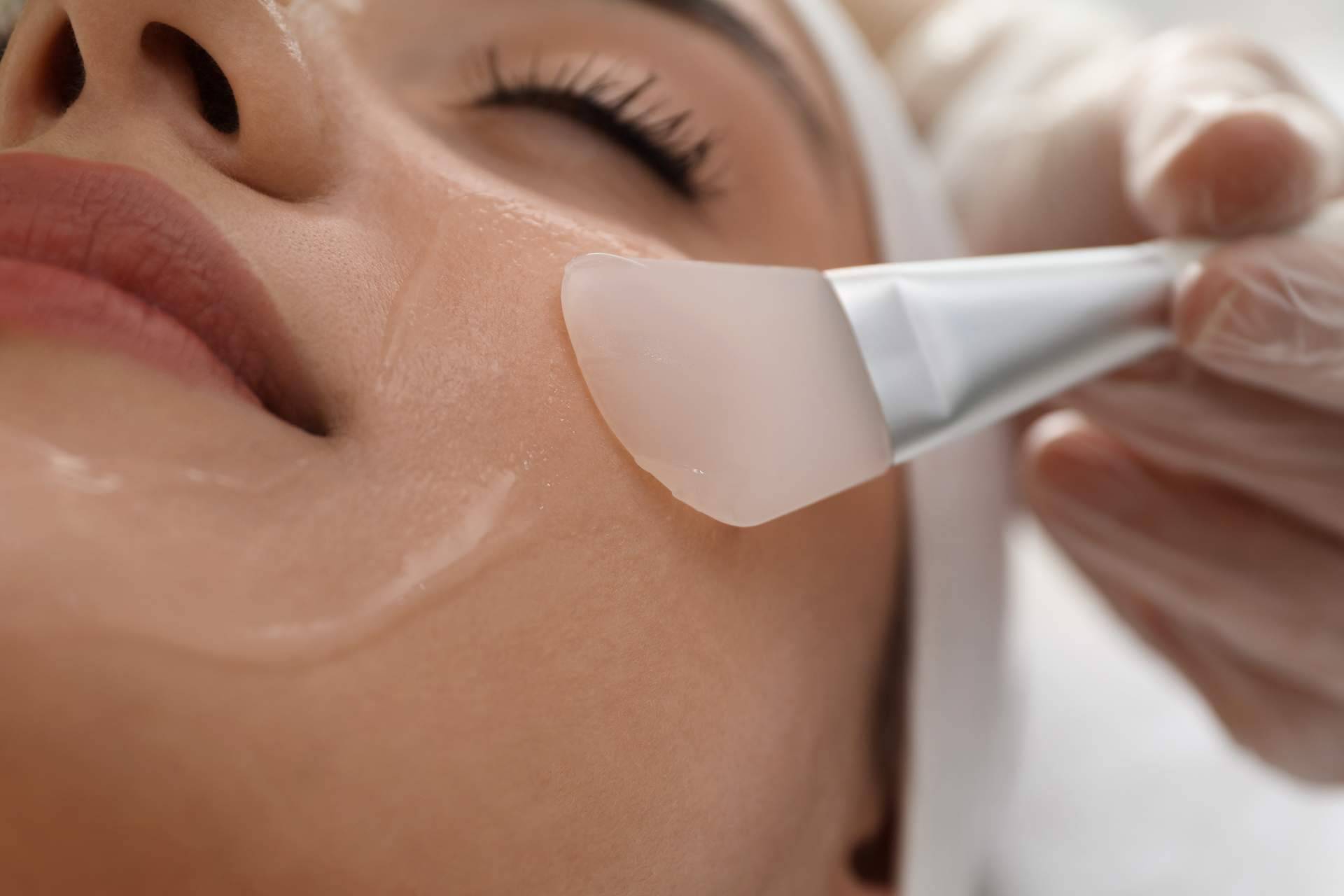 Alluring Clinic realiza peeling químicos como herramienta para luchar contra el envejecimiento facial