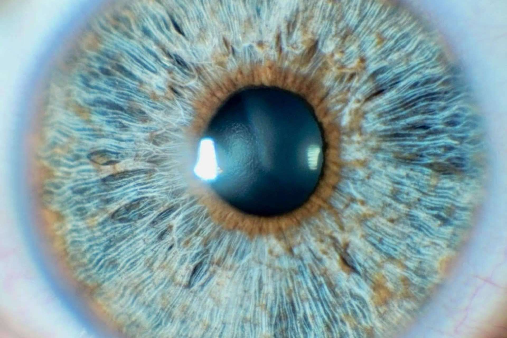 ¿Cuáles son las ventajas de la tecnología láser para cambiar el color de ojos?