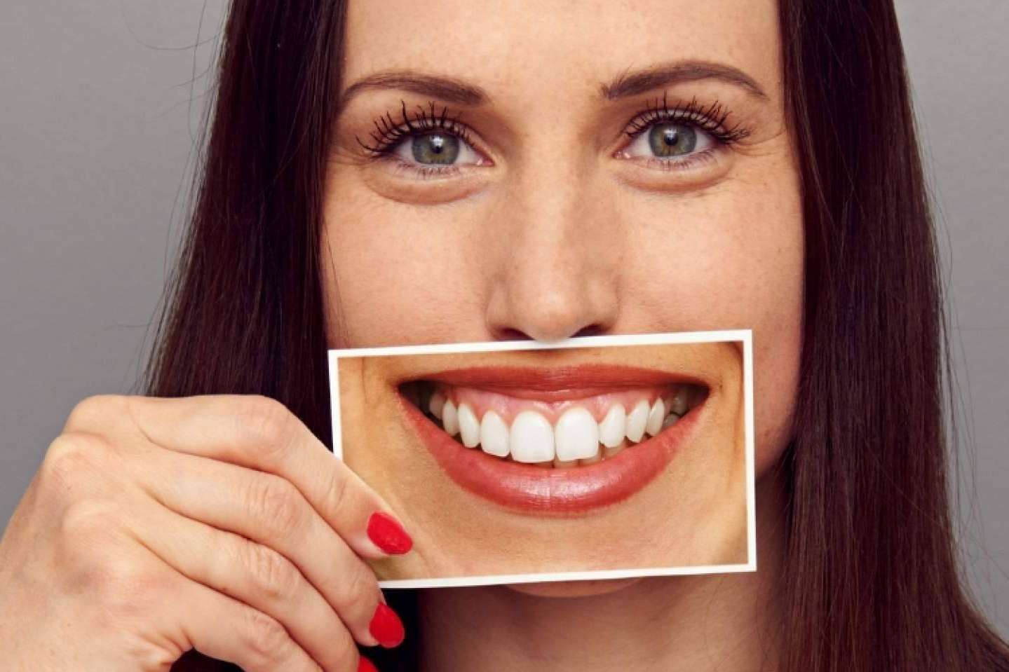 Clínica Dental Ruiz de Gopegui ofrece un tratamiento para la sonrisa gingival