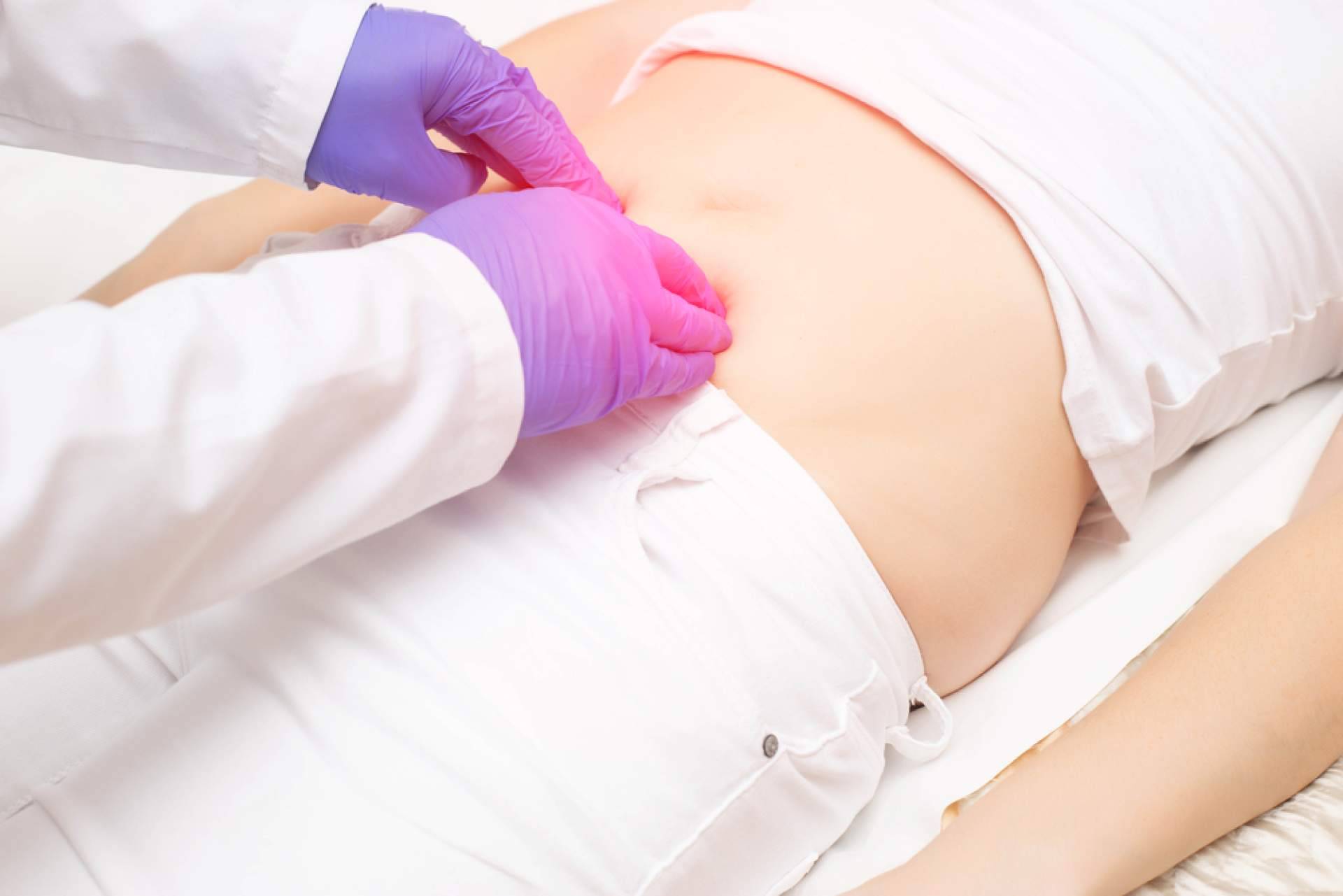 Resolviendo dudas sobre la cirugía de hernia inguinal, con el Dr. Javier Martínez Pascuas