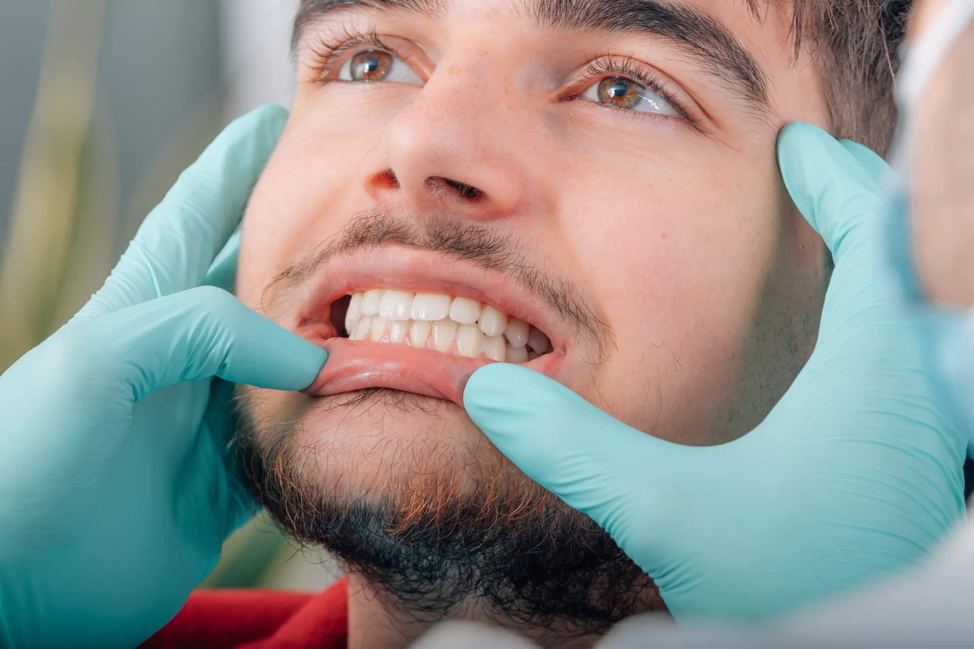 ¿Qué es la enfermedad de las encías y cómo tratarla según Clínica Dental Agudo Rosa?