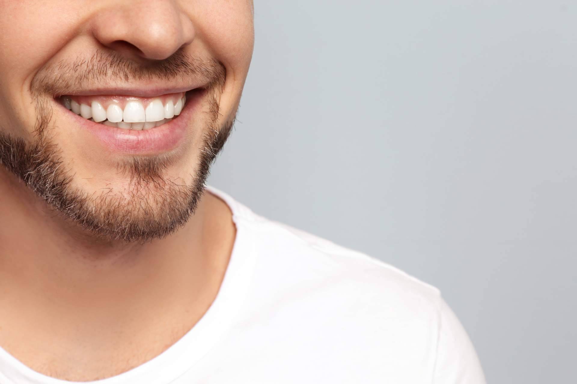 En qué consiste la cirugía de sonrisa gingival