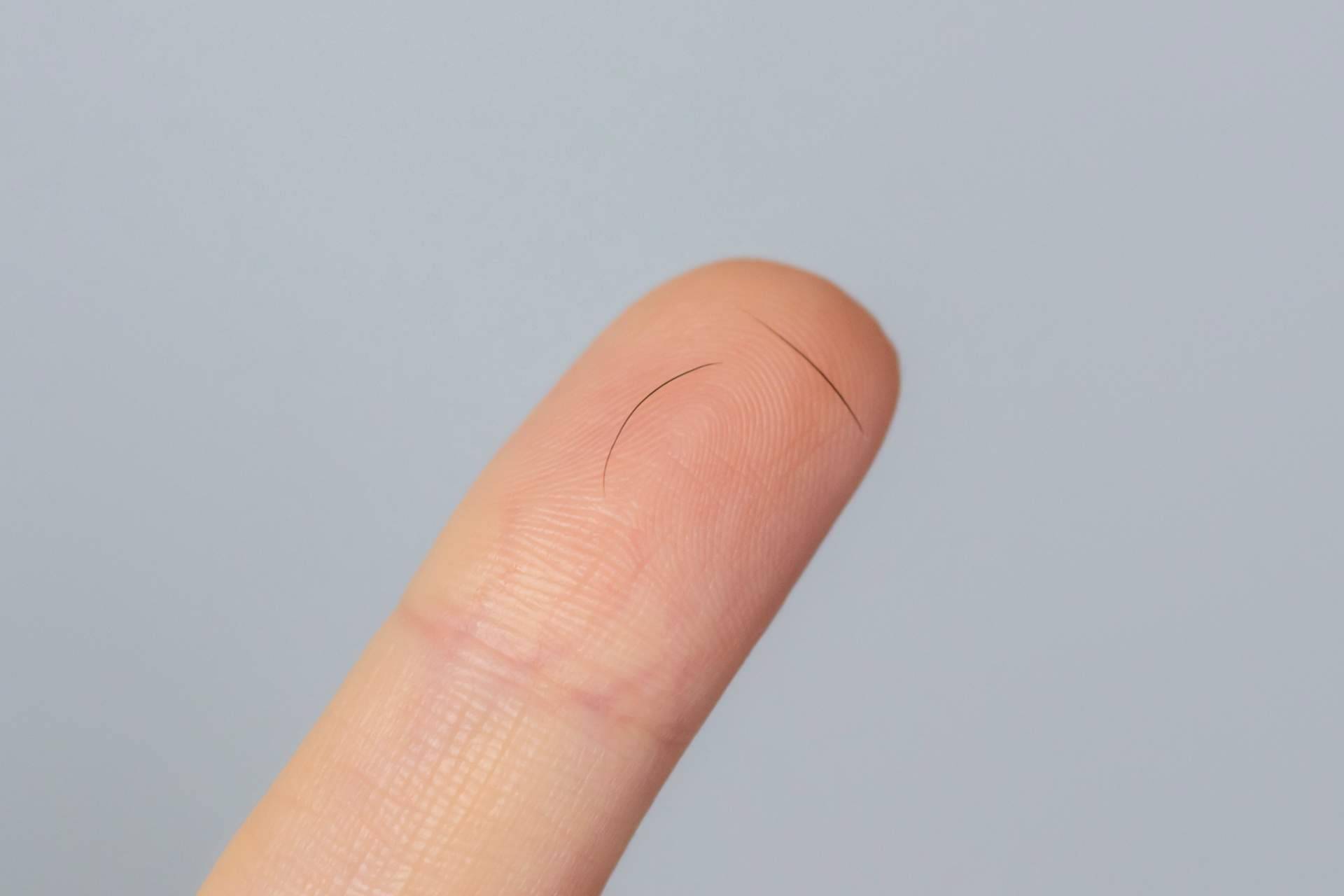 ¿Por qué se cae el pelo de las cejas? La explicación del Doctor Jesús Mora y Capilar Innovation Clinic