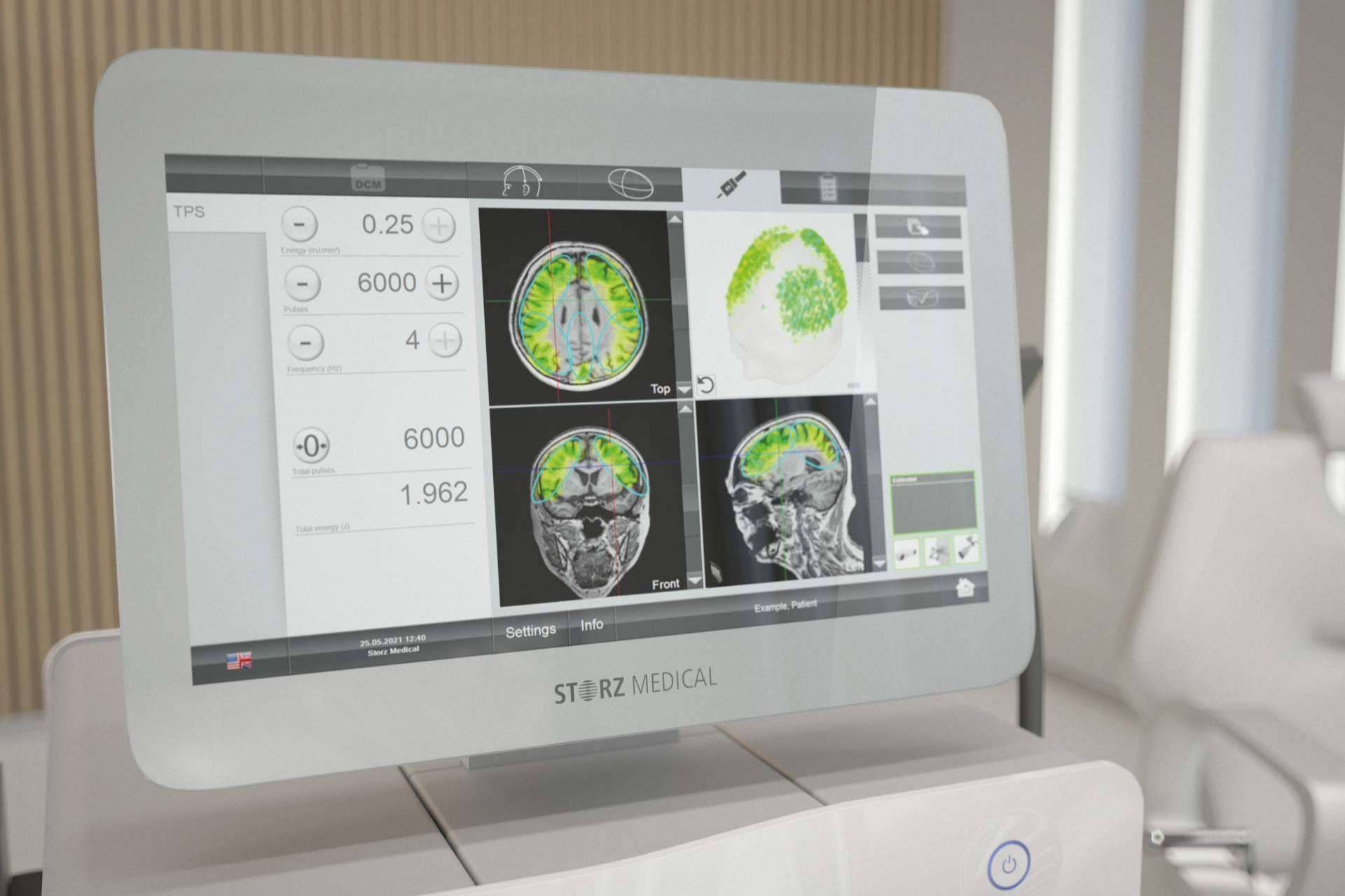 Innovación en Clínica DKF en el tratamiento del Alzheimer en fase temprana