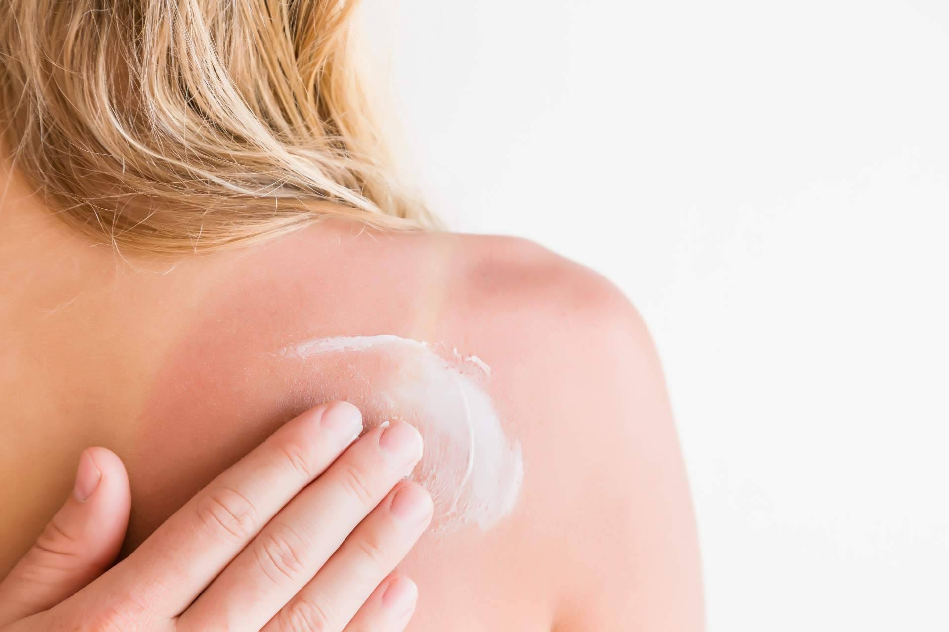 ¿Para qué sirve el after sun? Así­ hay que usarlo según Farmasky