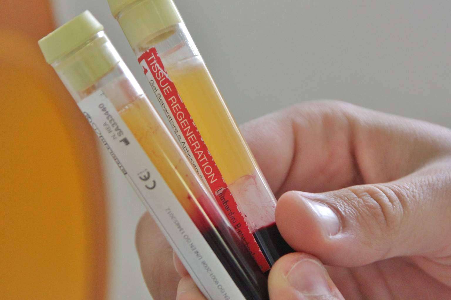 Volver a sonreír con salud a través del enfoque implantosofista de Clinica Biorigenera