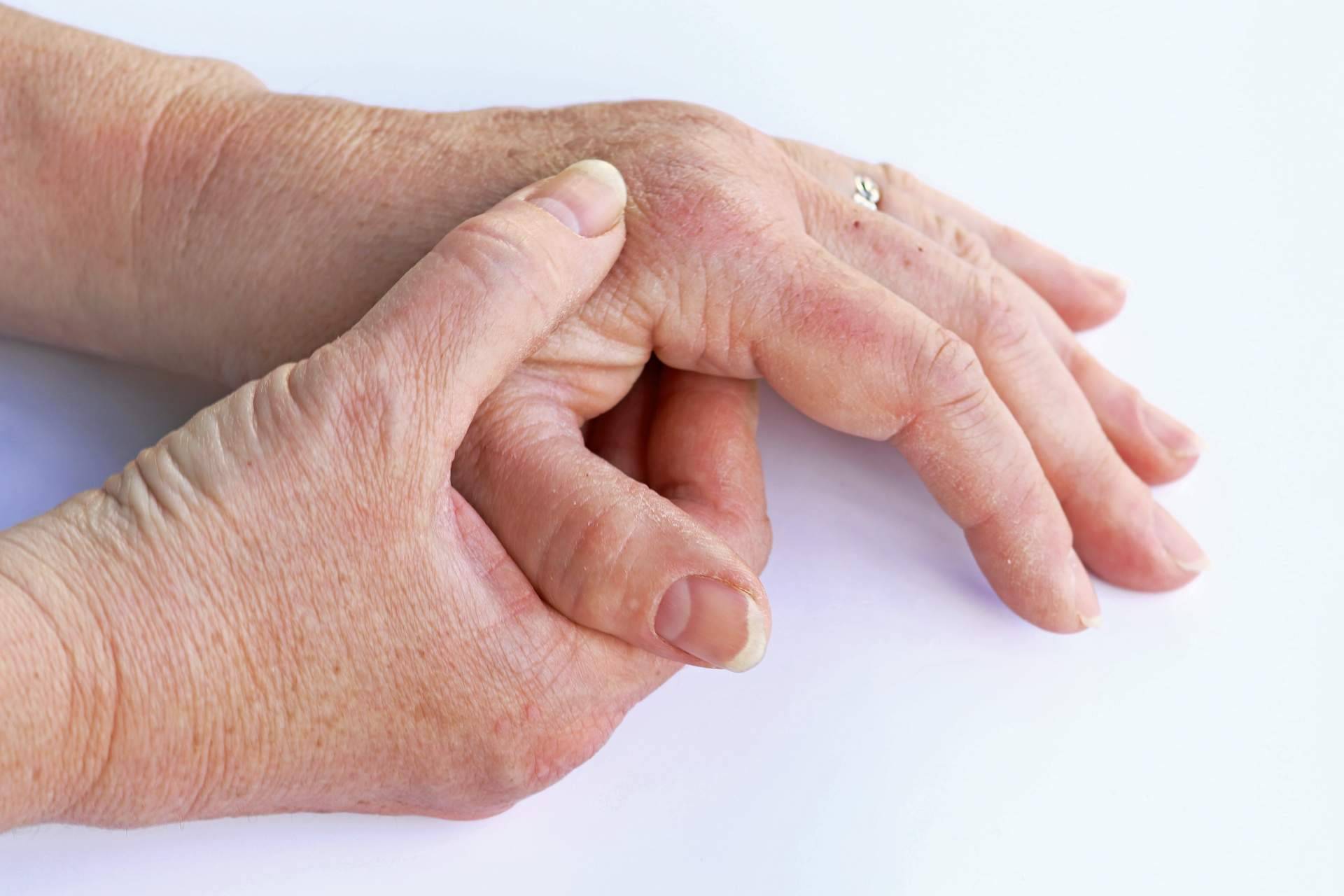 El 7º Congreso Internacional de Pacientes con Artrosis contará con la presencia de iXalud