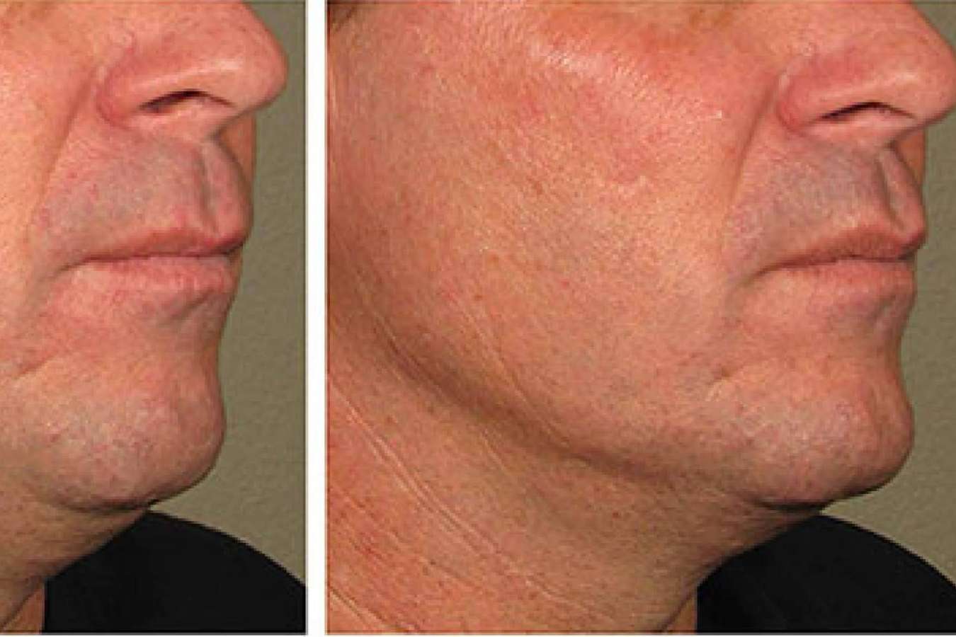 Clínica maxilofacial especializada en cirugías ortognáticas, Clínica Calvo de Mora