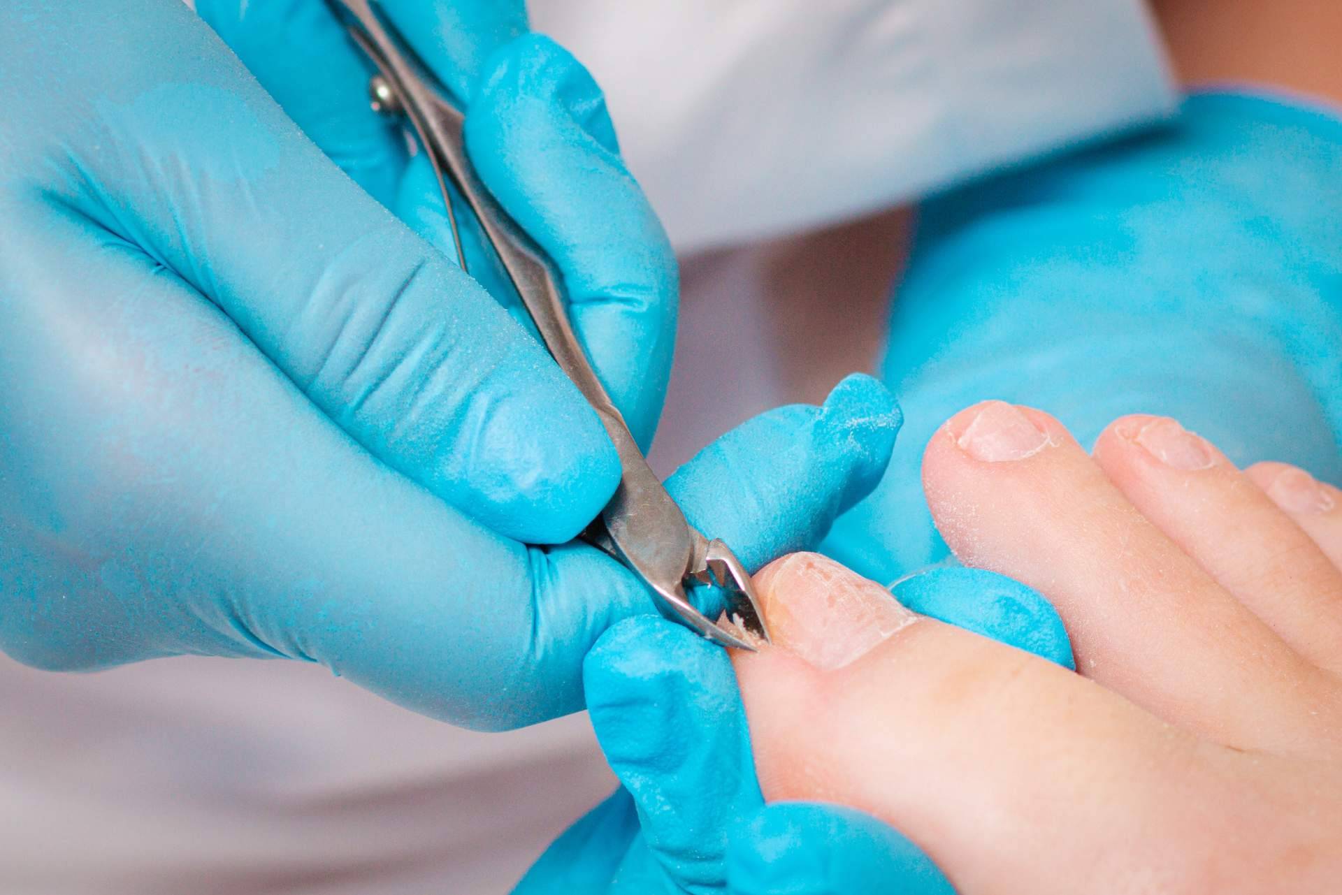 Podología en Madrid de la mano del Centro Médico El Pilar
