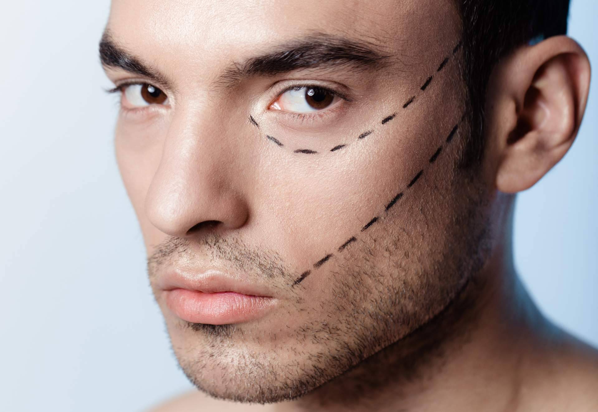 Medicina estética masculina, ¿cuáles son las nuevas tendencias y enfoques personalizados?