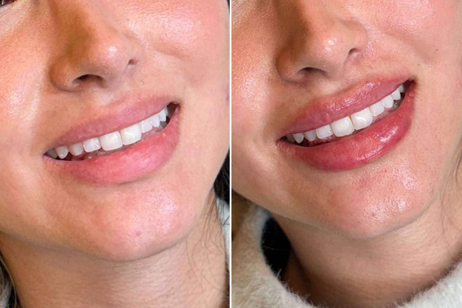 Holaglow presenta Glow Lips, la técnica que redefine el concepto de 'ponerse boca'